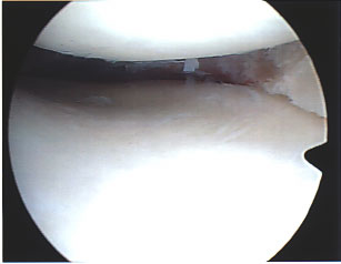 Notice how there's nothing there after the operation
